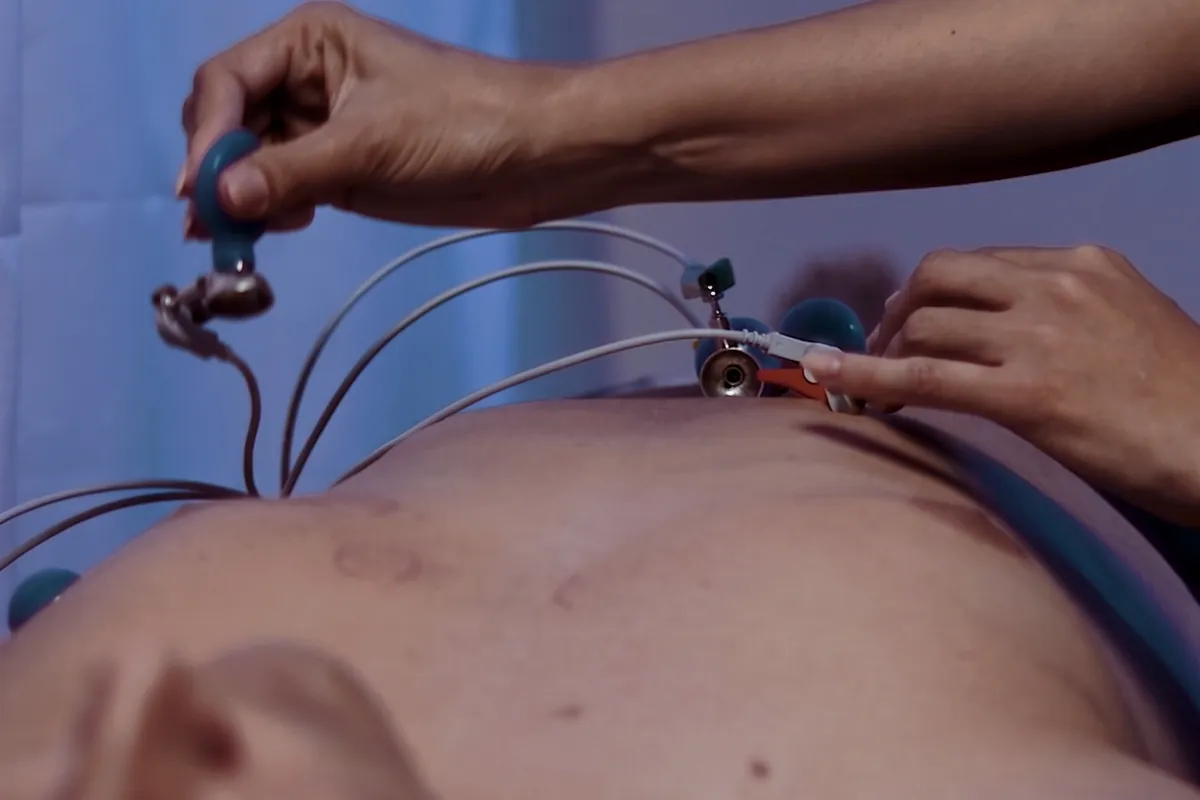 Profissional de enfermagem posiciona eletrodos de ECG no tórax de um paciente