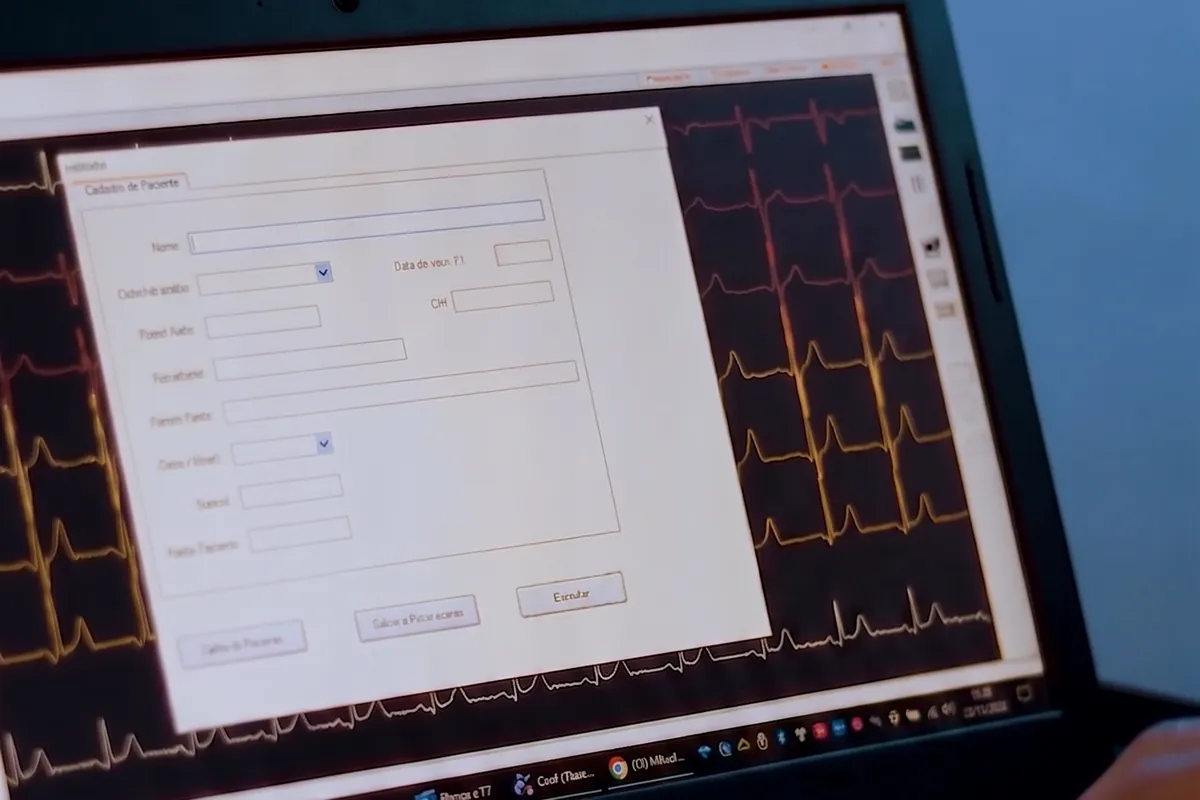 Tela da plataforma ECGPRO exibindo traçados de eletrocardiograma para análise